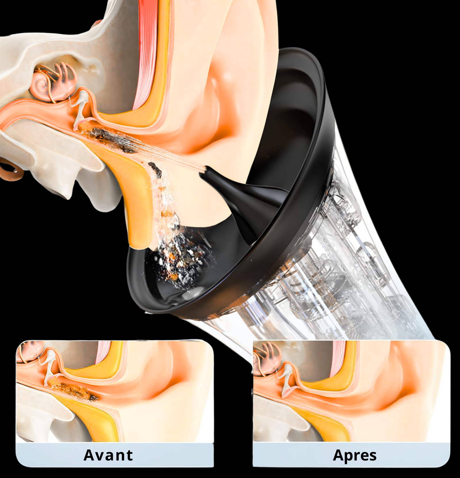 OTOPULSE