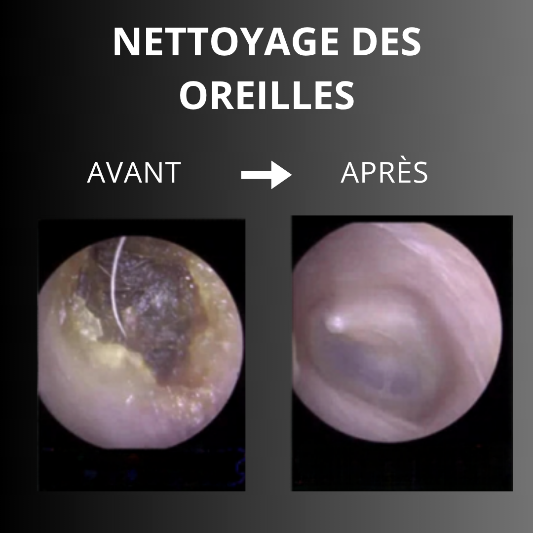 OTOPULSE